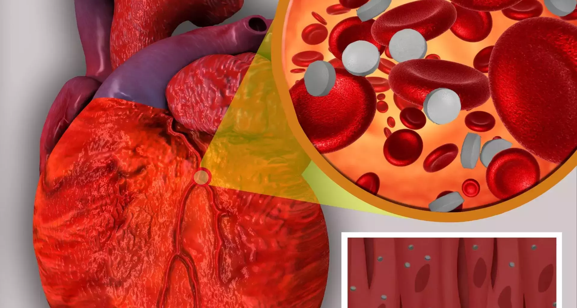 Nanomedicina en enfermedades cardiacas