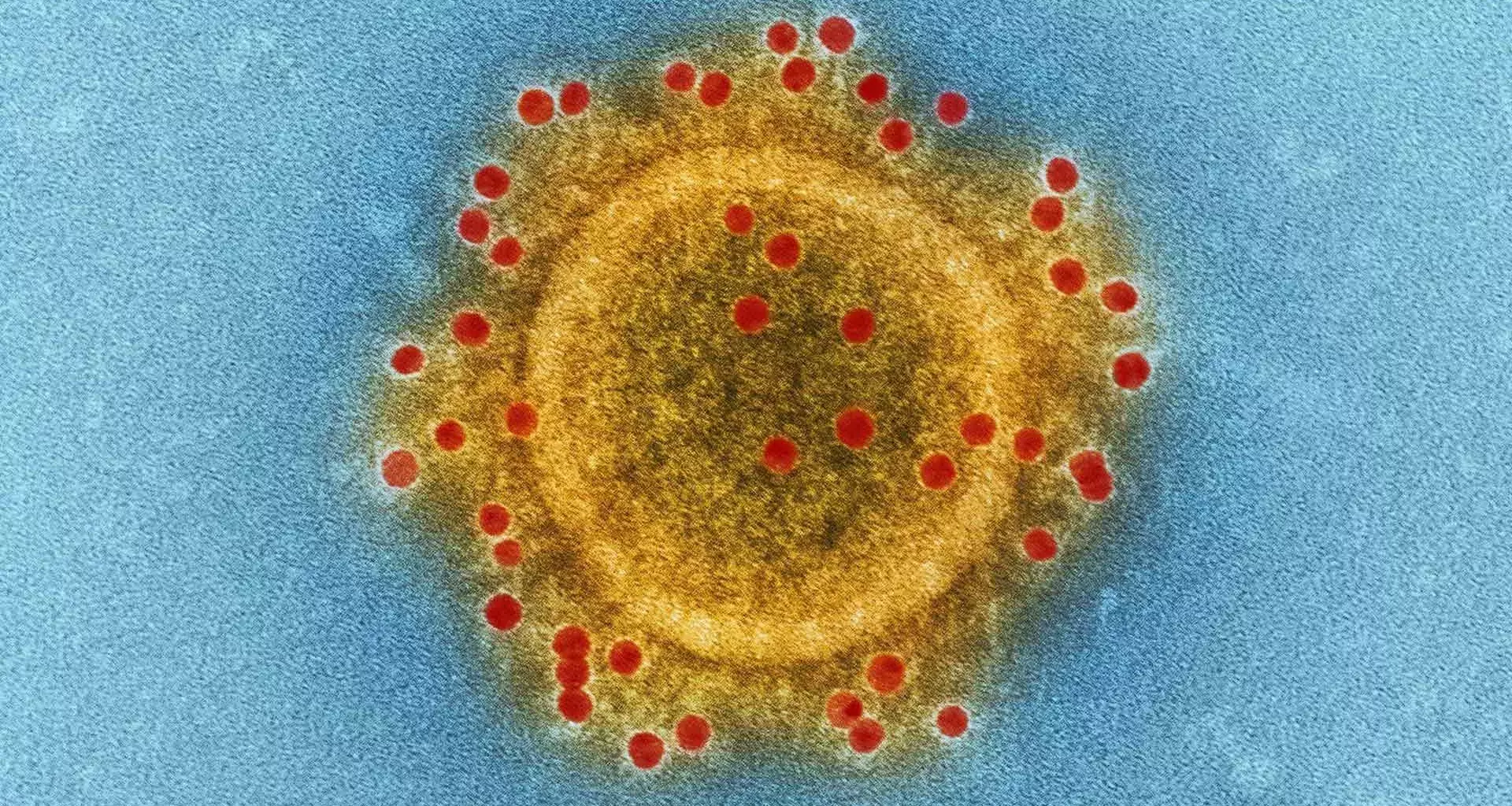 Tec using computational methods to study the Chinese coronavirus