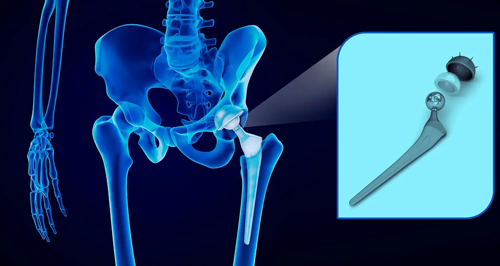 3D Technology! Augmented reality to improve pelvic surgery