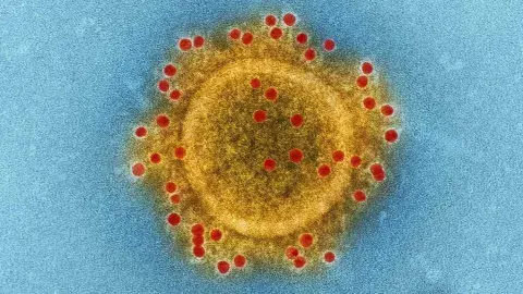 Utiliza Tec métodos computacionales para estudiar nuevo coronavirus 