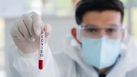 Mitos y preguntas usuales del coronavirus que causa el COVID-19 