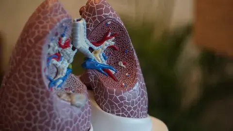 Desde la distancia: crean prototipo de respirador con impresión 3D