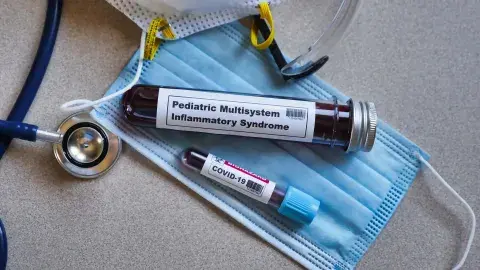 Síndrome inflamatorio multisistémico: reconócelo si tu hijo tuvo COVID