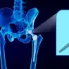 Crea sistema con realidad aumentada en cirugía de pelvis