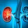 Estudiantes Tec ganan oro por iniciativa contra enfermedad renal