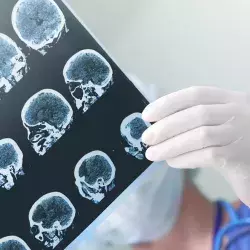 Mexicano desarrolla bisturí inteligente que detecta tumores cerebrales